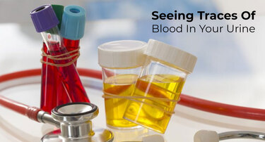 Why Are You Seeing Traces Of Blood In Your Urine